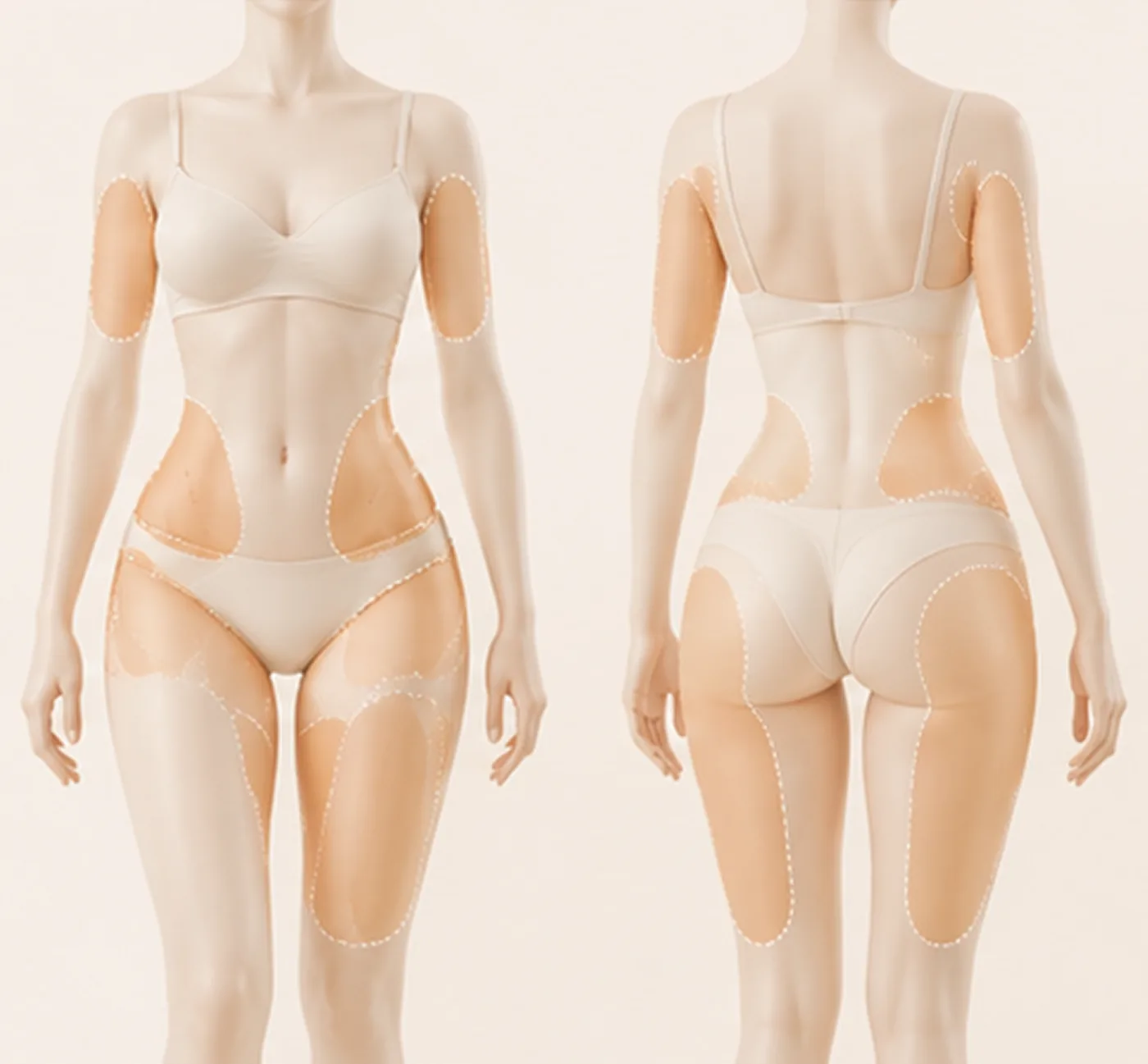 복부·팔뚝·옆구리·허벅지 고민 부위